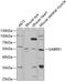 Gamma-Aminobutyric Acid Type A Receptor Rho1 Subunit antibody, GTX54153, GeneTex, Western Blot image 