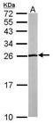 Na(+)/H(+) exchange regulatory cofactor NHE-RF2 antibody, PA5-21357, Invitrogen Antibodies, Western Blot image 