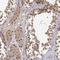 Casein Kinase 2 Alpha 1 antibody, HPA061698, Atlas Antibodies, Immunohistochemistry frozen image 