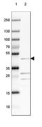 Solute Carrier Family 2 Member 1 antibody, NBP2-48609, Novus Biologicals, Western Blot image 