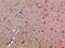 C-X-C Motif Chemokine Ligand 12 antibody, A00053, Boster Biological Technology, Immunohistochemistry paraffin image 