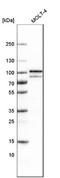 B-Raf Proto-Oncogene, Serine/Threonine Kinase antibody, NBP2-59035, Novus Biologicals, Western Blot image 