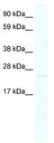 Mix Paired-Like Homeobox antibody, TA329102, Origene, Western Blot image 