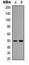 Bestrophin-2 antibody, orb323222, Biorbyt, Western Blot image 