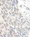 UV excision repair protein RAD23 homolog A antibody, NBP1-49977, Novus Biologicals, Immunohistochemistry paraffin image 