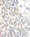 RAD23 Homolog A, Nucleotide Excision Repair Protein antibody, NBP1-49977, Novus Biologicals, Immunohistochemistry paraffin image 