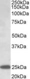 Abhydrolase Domain Containing 14B antibody, NBP2-26122, Novus Biologicals, Western Blot image 