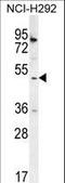 SH2 Domain Containing 4A antibody, LS-C169056, Lifespan Biosciences, Western Blot image 