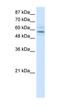 Transmembrane Protein 175 antibody, orb324531, Biorbyt, Western Blot image 