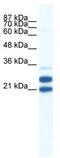 Tripartite Motif Containing 34 antibody, TA337927, Origene, Western Blot image 