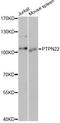 Protein Tyrosine Phosphatase Non-Receptor Type 22 antibody, A1406, ABclonal Technology, Western Blot image 
