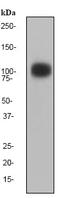 Gamma-Aminobutyric Acid Type B Receptor Subunit 2 antibody, ab75838, Abcam, Western Blot image 