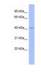 Complement Factor Properdin antibody, NBP1-58975, Novus Biologicals, Western Blot image 