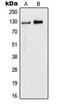 WD Repeat And HMG-Box DNA Binding Protein 1 antibody, GTX55930, GeneTex, Western Blot image 