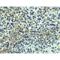 TNF Receptor Superfamily Member 10a antibody, LS-C267, Lifespan Biosciences, Immunohistochemistry paraffin image 