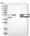 Adenosine Deaminase antibody, NBP1-90361, Novus Biologicals, Western Blot image 