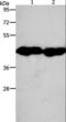 Creatine Kinase, M-Type antibody, LS-C405437, Lifespan Biosciences, Western Blot image 
