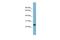 Charged Multivesicular Body Protein 1B antibody, PA5-44773, Invitrogen Antibodies, Western Blot image 