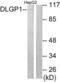 DLG Associated Protein 1 antibody, LS-C118656, Lifespan Biosciences, Western Blot image 