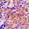 Acyl-CoA Thioesterase 2 antibody, LS-C354144, Lifespan Biosciences, Immunohistochemistry paraffin image 