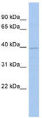 Kelch Like Family Member 35 antibody, TA334978, Origene, Western Blot image 