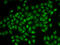 Coilin antibody, 22-214, ProSci, Immunofluorescence image 