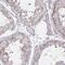 RAB6A, Member RAS Oncogene Family antibody, NBP2-32386, Novus Biologicals, Immunohistochemistry paraffin image 