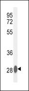 Carbonic Anhydrase 3 antibody, 63-077, ProSci, Western Blot image 