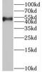 Synapse Associated Protein 1 antibody, FNab08409, FineTest, Western Blot image 