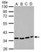 Purinergic Receptor P2Y12 antibody, NBP2-19660, Novus Biologicals, Western Blot image 