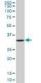 Solute Carrier Family 25 Member 5 antibody, H00000292-B01P, Novus Biologicals, Western Blot image 