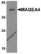 MAGE-X2 antigen antibody, 8191, ProSci, Western Blot image 