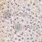 Heterogeneous Nuclear Ribonucleoprotein D antibody, A1828, ABclonal Technology, Immunohistochemistry paraffin image 