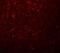 Potassium Two Pore Domain Channel Subfamily K Member 18 antibody, GTX85212, GeneTex, Immunohistochemistry paraffin image 