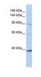 NCK Associated Protein 1 Like antibody, orb325354, Biorbyt, Western Blot image 