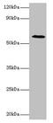 UTP--glucose-1-phosphate uridylyltransferase antibody, CSB-PA620986HA01HU, Cusabio, Western Blot image 