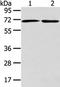 ADP Ribosylation Factor GTPase Activating Protein 2 antibody, TA351972, Origene, Western Blot image 