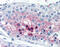 Cathepsin V antibody, 51-104, ProSci, Immunohistochemistry paraffin image 