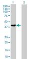 FYVE, RhoGEF And PH Domain Containing 6 antibody, H00055785-B01P, Novus Biologicals, Western Blot image 