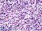 BRCA1 Associated Protein 1 antibody, LS-B4874, Lifespan Biosciences, Immunohistochemistry frozen image 