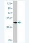 Dual Serine/Threonine And Tyrosine Protein Kinase antibody, H00025778-M03, Novus Biologicals, Western Blot image 