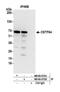Cleavage Stimulation Factor Subunit 2 antibody, NB100-57530, Novus Biologicals, Western Blot image 