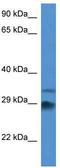 Outer Dense Fiber Of Sperm Tails 1 antibody, TA335658, Origene, Western Blot image 