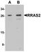 RAS Related 2 antibody, A04117, Boster Biological Technology, Western Blot image 