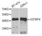 Insulin Like Growth Factor Binding Protein 4 antibody, LS-C346060, Lifespan Biosciences, Western Blot image 