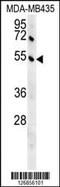 G Kinase Anchoring Protein 1 antibody, MBS9203476, MyBioSource, Western Blot image 