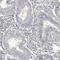 RBMX Like 2 antibody, PA5-58588, Invitrogen Antibodies, Immunohistochemistry paraffin image 