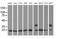 Rho GDP Dissociation Inhibitor Alpha antibody, MA5-25081, Invitrogen Antibodies, Western Blot image 