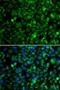 Trimethyllysine Hydroxylase, Epsilon antibody, orb373609, Biorbyt, Immunofluorescence image 