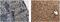 Interleukin 1 Receptor Type 2 antibody, NB110-85472, Novus Biologicals, Immunohistochemistry paraffin image 